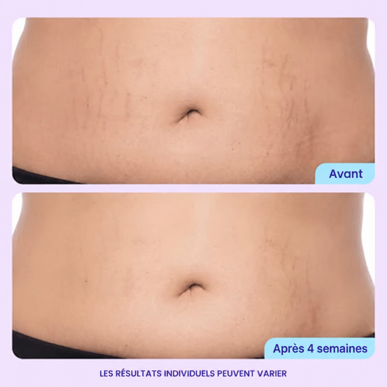 Crème raffermissante et lissante pour le ventre