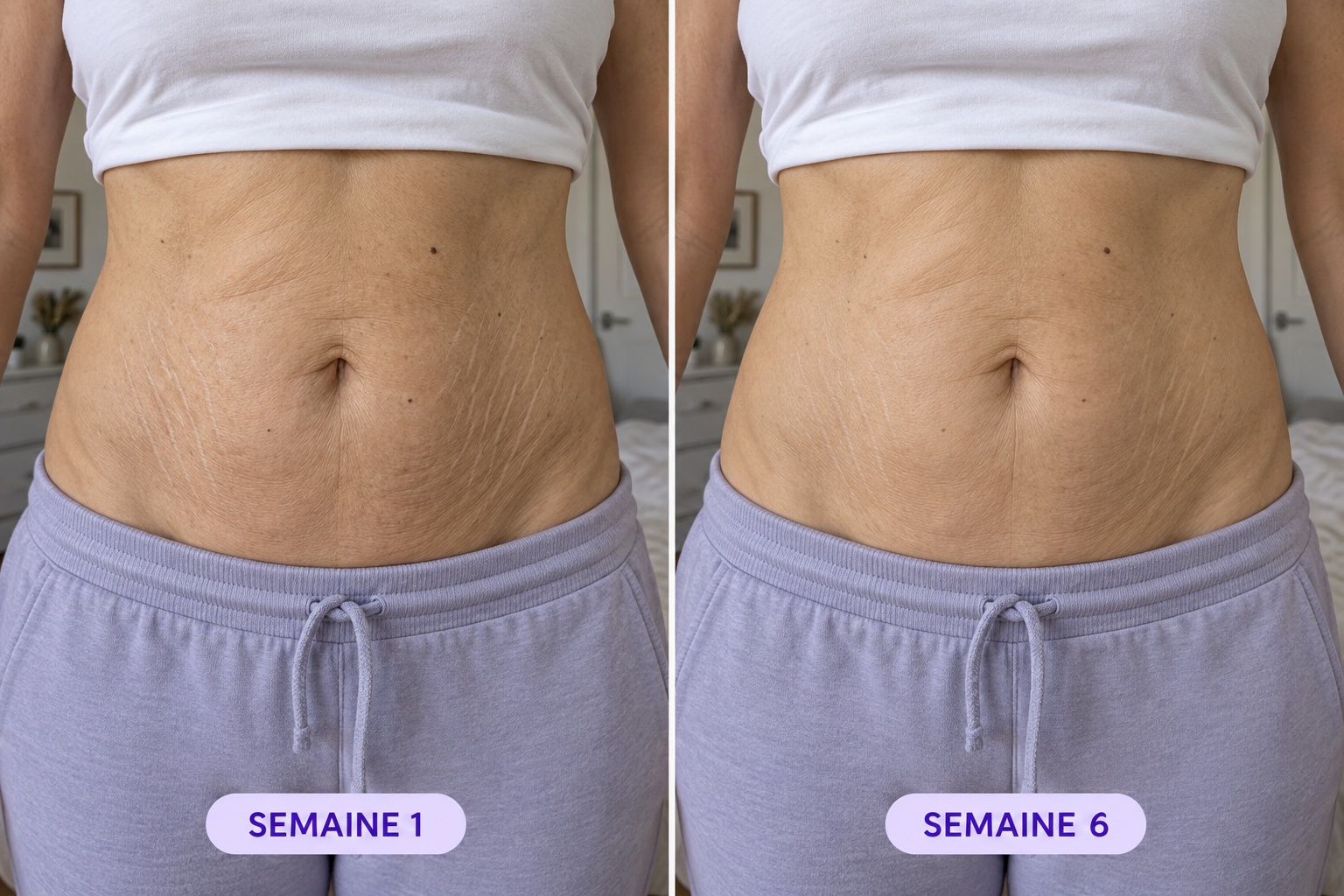 Comparaison de la peau du ventre, semaine 1 et semaine 6